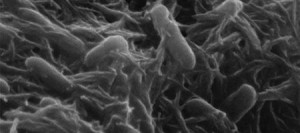 bacteria