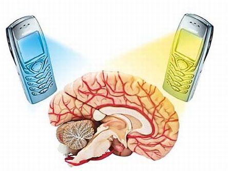 Mobile Phones and The Influence of Radio Frequency Fields on Human Health Mobile Phones and The Influence of Radio Frequency Fields on Human Health